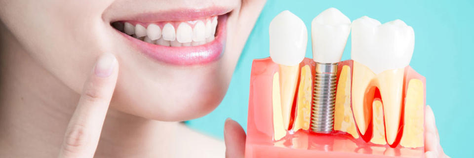 Современные способы протезирования зубов
